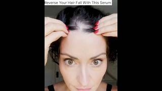 🔥Most Powerful Hair Growth serum😱| Hair Growth Tips ✅ #shorts #longhair #haircare