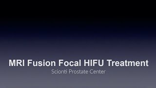 MRI Fusion Guided Focal HIFU Treatment