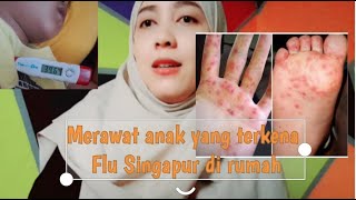 Cerita pengalaman saat anaku terkena flu singapur | HMFD