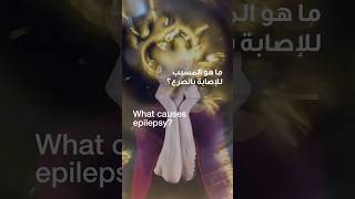 Causes of Epilepsy | Dr. Amir Abdelghaffar | Reem Hospital Abu Dhabi