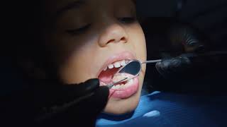 The First Dental Check-up Is Important to a Child. Learn More with Dr Seema Raina!