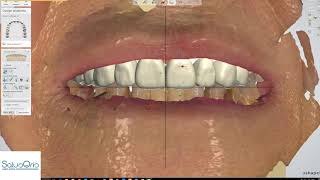 Face guided design for oral rehabilitation