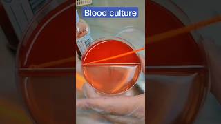 blood culture procedure steps in microbiology #dmlt #labtech #labstatus #whwhatsapp_status_2022_new