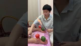 FIRE CUPPING THERAPY  ||  HIJAMA || #health #alternativetherapy #firecupping #cuppingtherapy