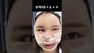 자신있게 셀카찍기 #plasticsurgeryinkorea