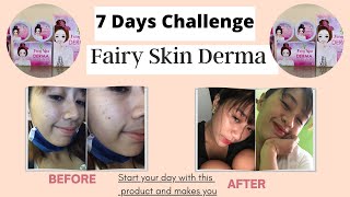 Fairy Skin Derma 7 Days Challenge - Honest Review | MsJoan Santos