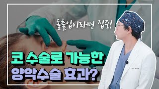 코성형하면 돌출입이 들어가 보인다?! 고양이수술(비순각수술)과 귀족수술