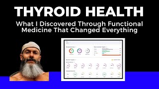 Thyroid Health: What I Discovered Through Functional Medicine That Changed Everything