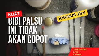 Membuat & Pasang Gigi Palsu Sendiri.