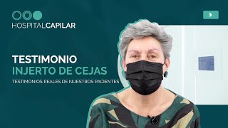 TESTIMONIO cirugía de INJERTO DE CEJAS | La experiencia de nuestros pacientes 💯