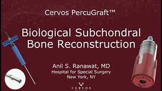 Biological Subchondral Bone Reconstitution by Dr. Ranawat