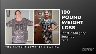 Plastic Surgery Patient Journey Video : Danica - 190 Pound Weight Loss Transformation (Part One)