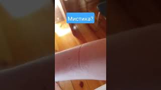 Полоска на руке 🤔 всё продолжается