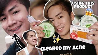 HOW I CLEARED MY ACNE USING THIS PRODUCT!✨ JOURNEY ACNE PIMPLES!♥️