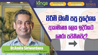 Dr  Amila Siriwardena - Did the chest area protrude abnormally for men as well?