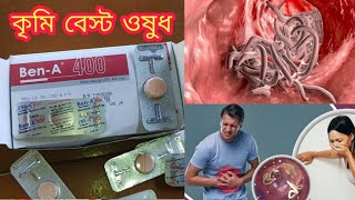 Ben A 400Mg Tablets পেট এ কৃমি হলে খাবেন কি ভাবে খাবেন নিয়ম তা দেখুন দাম কত সব কিছু ।