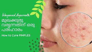 BEST AYURVEDA TIP FOR PIMPLES