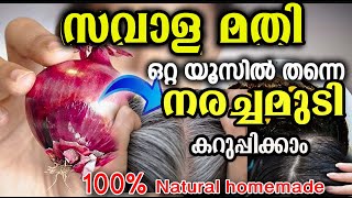 വെളുത്ത നരച്ച മുടി ഒറ്റയൂസിൽ കരിപോലെ /onion hair dye /poppy vlogs /malayalam