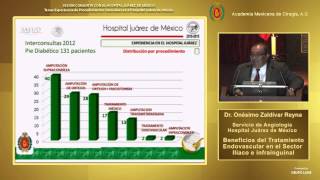 Beneficios del Tratamiento Endovascular en el Sector Iliaco e Infrainguinal, Dr. Onésimo Zaldívar