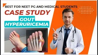 Gout | Gout symptoms | Gout treatment | Hyperuricemia | Case study #biochemistry | Alcohol and Gout