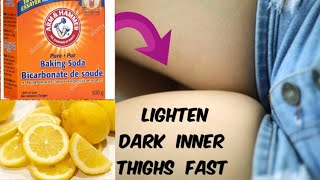 How To Lighten Dark Inner Thighs Naturally And Fast