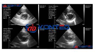 Wifi&USB cardiac probe from Beijing Konted