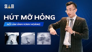 HÚT MỠ HỎNG - NỖI ÁM ẢNH KINH HOÀNG | CEO THÁI HOÀNG SƠN