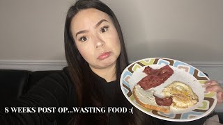 8 WEEKS POST OP | GASTRIC BYPASS | HOW MUCH I EAT