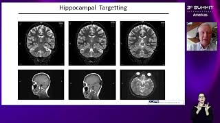 NEUROLOGIA MESA 2 Avanços nos Tratamentos de Doenças