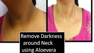 Remove DARKNESS around NECK using ALOE VERA| Home remedy for Neck Darkness| Starnaturalbeauties