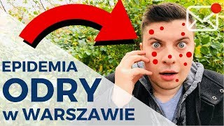 EPIDEMIA ODRY W WARSZAWIE *skąd się wzięła?*