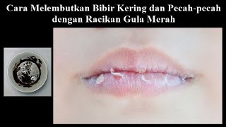 Cara Melembutkan Bibir Kering dan Pecah pecah dengan Racikan Gula Merah