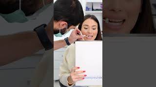 CROWNS AND VENEERS BEFORE AND AFTER | DENTAL IMPLANTS | SMILE DESIGN TURKEY | DENTIST TURKEY |