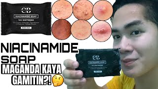 NIACINAMIDE SOAP REVIEW! TRENDING SA TIKTOK  ANG SABON NA TO!?😱