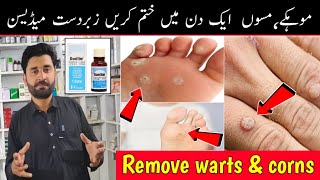 warts treatment | corns treatment | duofilm lotion uses | how to uses duofilm lotion | foot corns