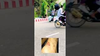 accident 😥😱 #1millionviews । Natore skating club