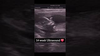 14 Week Ultrasound 🎀 #14weeks #ultrasound #pregnancy #pregnancyjourney #pregnant #babygirl #daughter