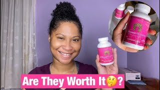 Canvas Beauty Hair Blossom Vitamins Review | 30 Day Challenge