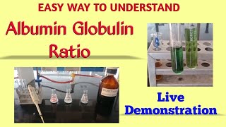 Albumin globulin ratio | Total protein estimation | Biuret method | Albumin estimation | BCG method