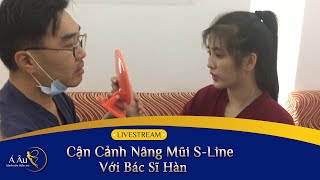 Cận cảnh ca Nâng mũi cấu trúc S-line sửa mũi gồ với BS Hàn