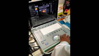 Beijing Konted C7 Color doppler ultrasound Machine