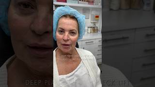 Full Face Rejuvenation - Insane Facelift Transformation