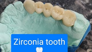 zirconia tooth 🦷#viralvideo