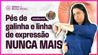 Rugas e linhas de expressão nunca mais de forma natural | Aquecimento Semana da Beleza Natural