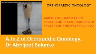 Above Knee Ampuation patient with a Artificial Leg