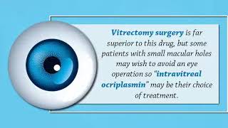 How to Get Rid of Macular Hole?