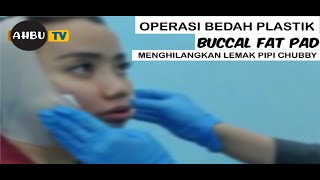 OPERASI BEDAH PLASTIK BUCCAL FAT PAD - OPERASI BUANG LEMAK PIPI - CARA TIRUSIN MUKA V SHAPE PERMANEN