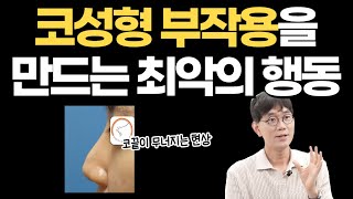 코성형 후 코끝이 떨어지는 이유