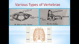 Skeletal system Various Types of Vertebrae Part 4| types of vertebrae?|What are vertebrae? #skeletal