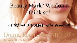 Removing those beauty marks!